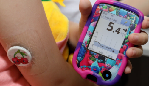 Анастасия Ракова: В Москве все дети с диабетом первого типа смогут бесплатно получить системы непрерывного мониторинга глюкозы