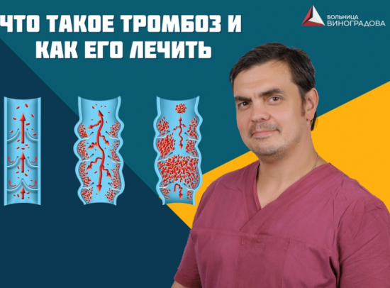 Хирург ГКБ им. В. В. Виноградова рассказал, как лечить тромбоз