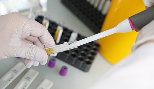 В Москве более 165 тыс человек сдали тесты на антитела к COVID-19