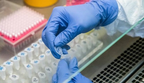 В Конькове зафиксировано 8 случаев вызовов по коронавирусу