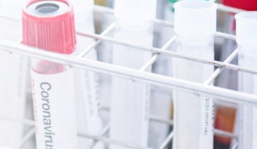 Процедурные кабинеты для бесплатного тестирования на иммунитет к коронавирусу будут открыты на базе второго филиала ДКЦ № 1