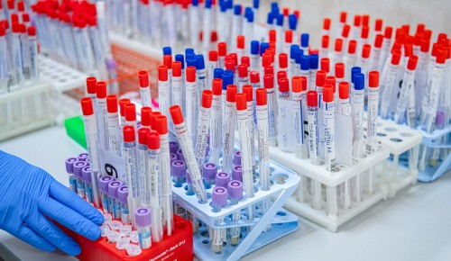 В Москве сделано уже 730 тысяч тестов на коронавирус