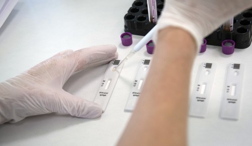 Собянин объявил о массовом тестировании москвичей на антитела к COVID-19