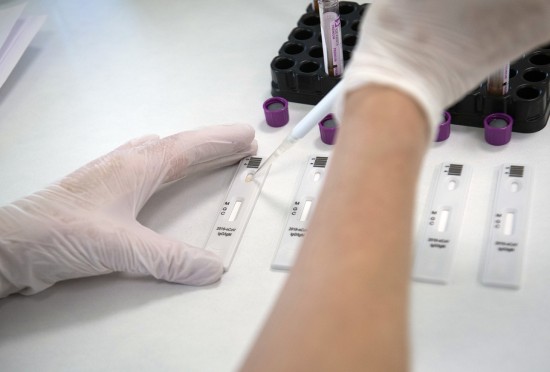 Собянин объявил о массовом тестировании москвичей на антитела к COVID-19