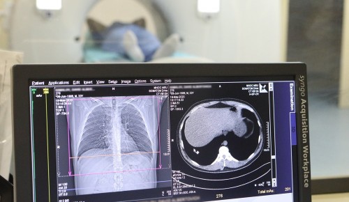 Обновление медоборудования в Москве позволит увеличить число цифровых исследований до 10 млн