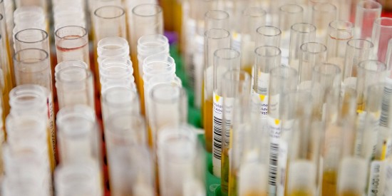 Москва привлекла частные лаборатории к проведению тестов на коронавирус