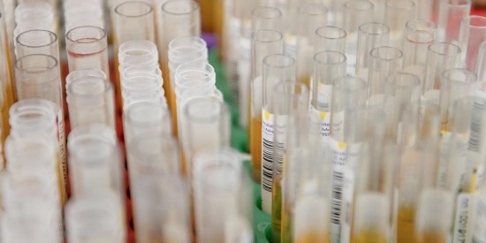 Сдать тест на антитела к коронавирусу можно во втором филиале ДКЦ № 1