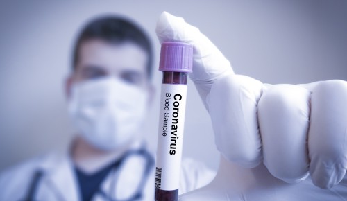 Жители района Зюзино могут сдать анализ на антитела к COVID-19 бесплатно 