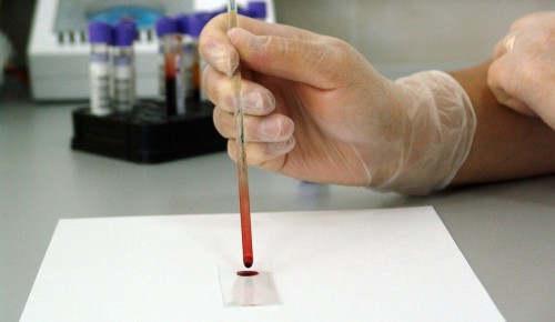 В Москве более 165 тыс человек сдали тесты на антитела к COVID-19